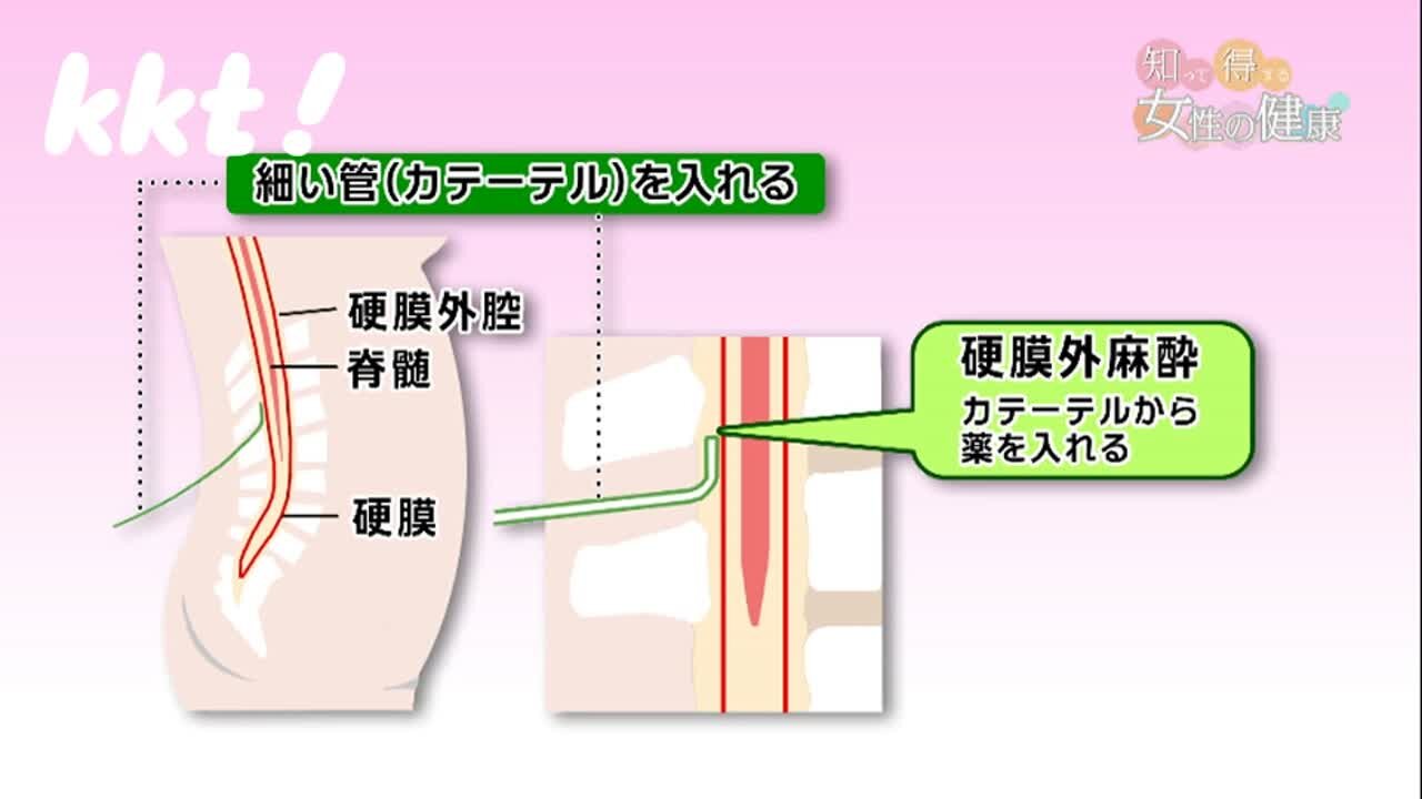 20230118無痛分娩の流れ3_N.jpg